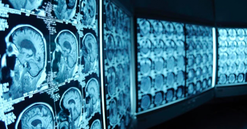 Neurociencia y minería: científicos estudiarán la relación entre máquinas y cerebro humano